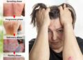Best creams for psoriasis 2025, recommended by a dermatologist | The ...