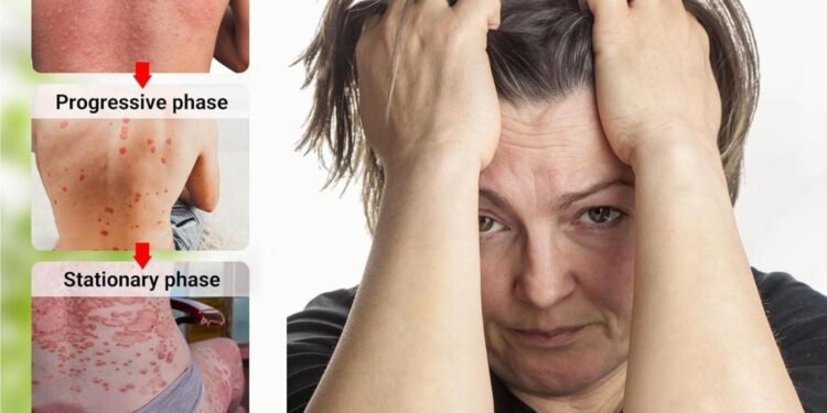 Best creams for psoriasis 2025, recommended by a dermatologist | The ...