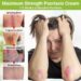 Best creams for psoriasis 2025, recommended by a dermatologist | The ...