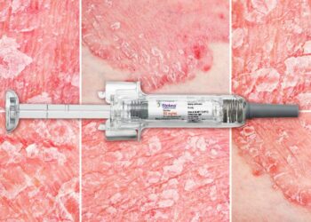 For Safety, One Biologic a Winner in Psoriasis, Psoriatic Arthritis ...