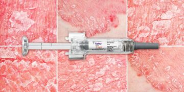 For Safety, One Biologic a Winner in Psoriasis, Psoriatic Arthritis ...