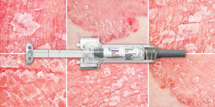 For Safety, One Biologic a Winner in Psoriasis, Psoriatic Arthritis ...